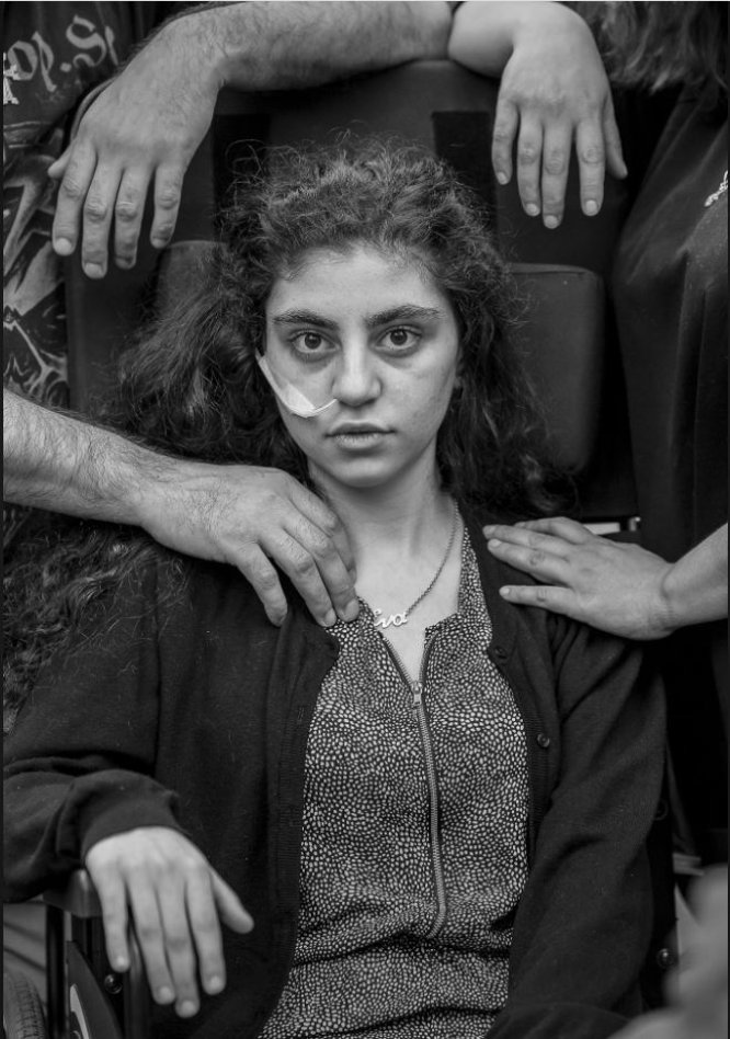 Una niña armenia de 15 años que despertó del estado catatónico provocado por el Síndrome de Resignación