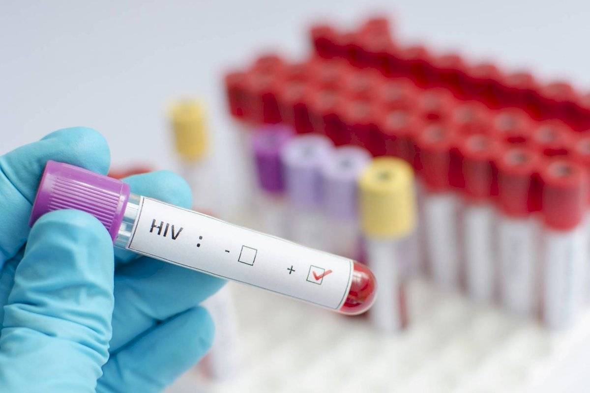 Se confirma segundo caso de paciente con VIH curado