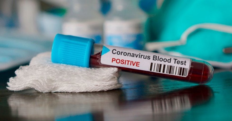 ¿Si tu sangre es tipo A corres más riesgo de contraer coronavirus?