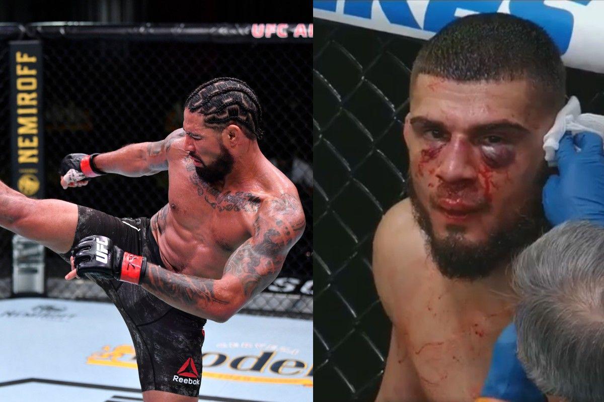 (VIDEO)-Max Griffin desprende oreja a Ramiz Brahimaj durante pelea de UFC.