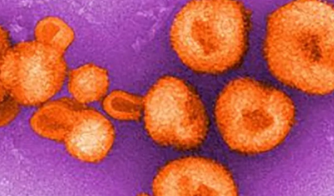Preocupación de científicos por brote de virus parecido al ébola