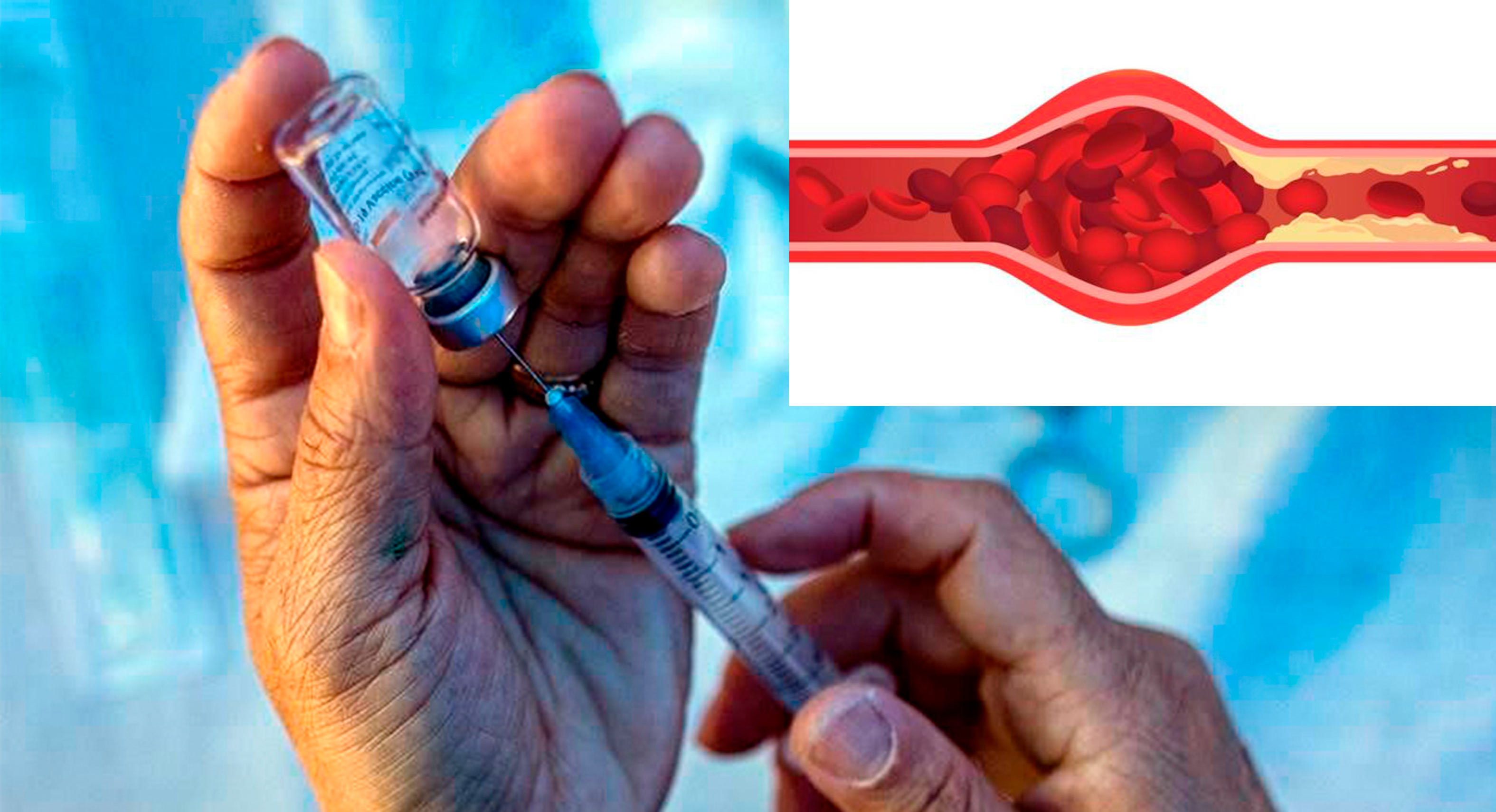 ¿Por qué suspendieron la vacuna de AstraZeneca en algunos países?