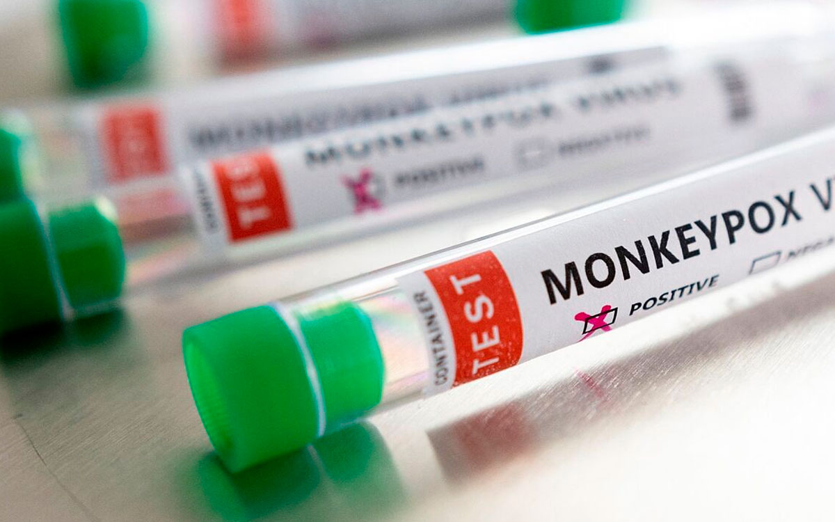 OMS declara emergencia internacional por la viruela del mono ¿Qué pasará?